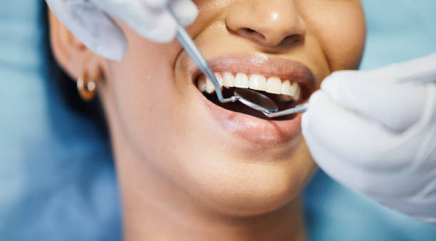 Best Emergency Wisdom Teeth Removal in Jacksonville, FL